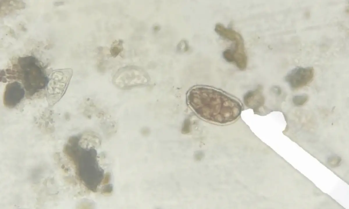 Parasitologia Digital: Diagnóstico Veterinário Automatizado